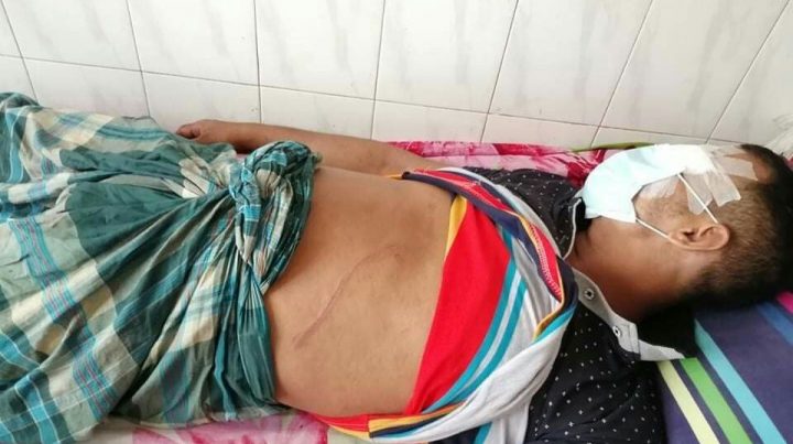 মাদারীপুরের শিবচরে পূর্ব শত্রুতার জের ধরে যুবককে কুপিয়ে হত্যাচেষ্টা