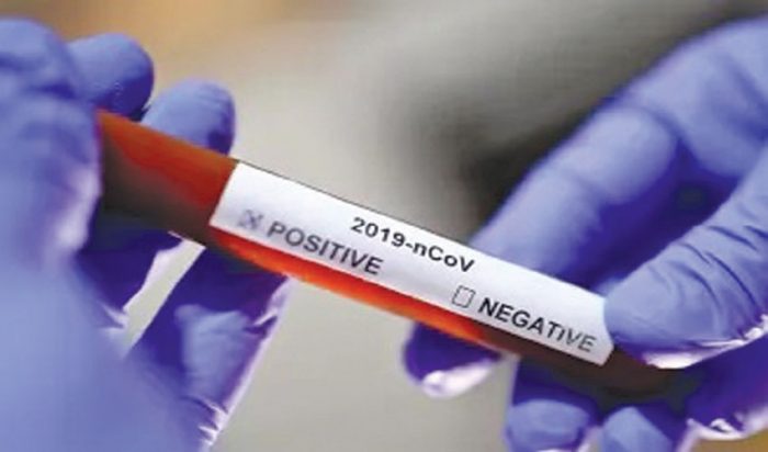 ঝিনাইদহে করোনা ও উপসর্গে ৪ জনের মৃত্যু, নতুন আক্রান্ত ২৩০