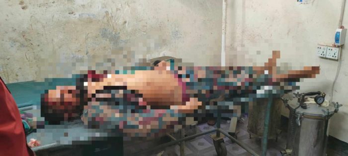 বেনাপোল পুটখালী সীমান্তে সড়ক দূর্ঘটনায় নিহত বিজিবি সদস্য -১, আহত-১।