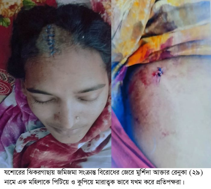 ঝিকরগাছায় আদালতে মামলা করায় হুমকি, জমিজমা সংক্রান্ত বিরোধে মহিলা যখম!