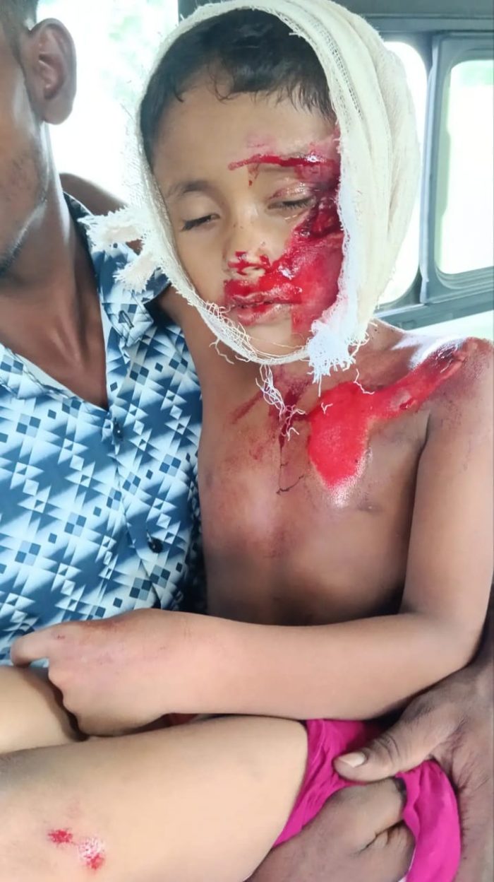 সড়ক দুর্ঘটনায় আহত শিশু তাজবীর’কে বাঁচাতে এগিয়ে আসুন