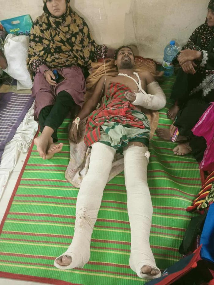 শার্শায় যুবদল কর্মিকে অপহরণ করে লোহার রড ও হকিস্টিক দিয়ে হাত পা ভাঙলো প্রতিপক্ষ।